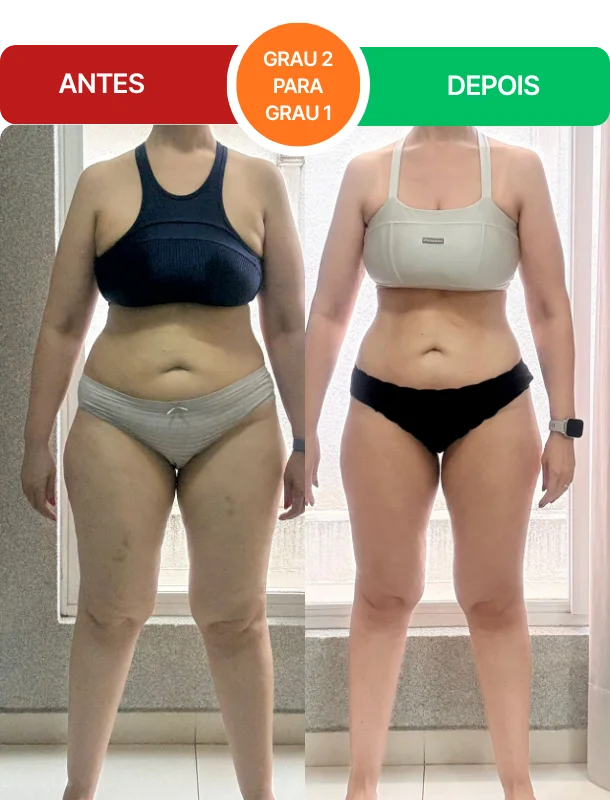 Antes e depois real de aluna do protocolo